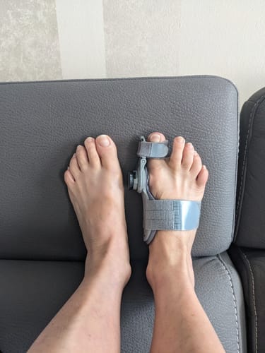 My bunions are very severe. I’m at the point of requiring surgery. I have had them for 45 years. I now have severe hammertoes. I doubted the product but I was willing to try because of the 90 day guarantee.   After two uses, I am noticing significant stretching in tendons and muscles. This device is intelligently designed and comfortable to wear. I find I can already walk in them for short distances while wearing while relaxing. I feel I will be able to wear to bed soon as well. I’m hoping that ...