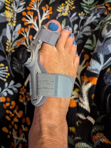As you can see I have a severe bunion, 6 weeks in I’m not in as much pain as I was in at the beginning. I actually bought 2 more straps and I will sleeping with it all night.